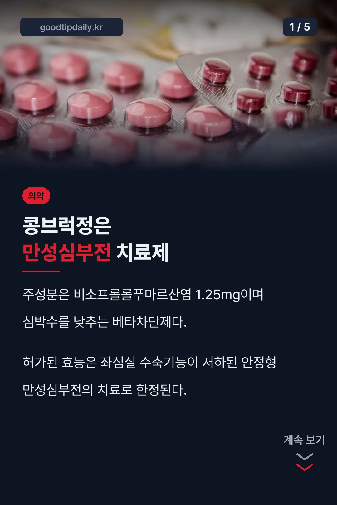 콩브럭정 1.25 핵심 요약